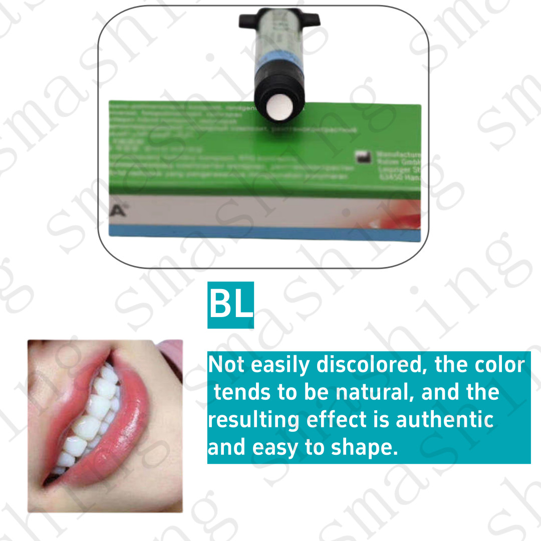 Dental KULZER CHARISMA Composite Resin Diamond Bleach White Light Cure BL BXL OB