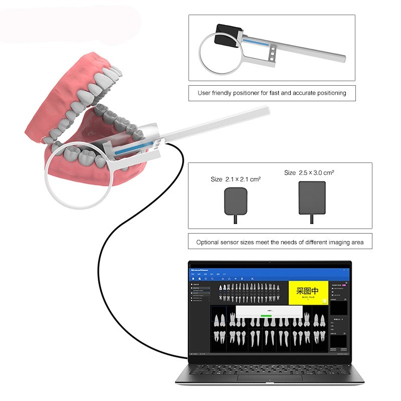 1 year Warranty Dental Sensor Portable Sensor Digital Sensor HD Dental Lab Tools