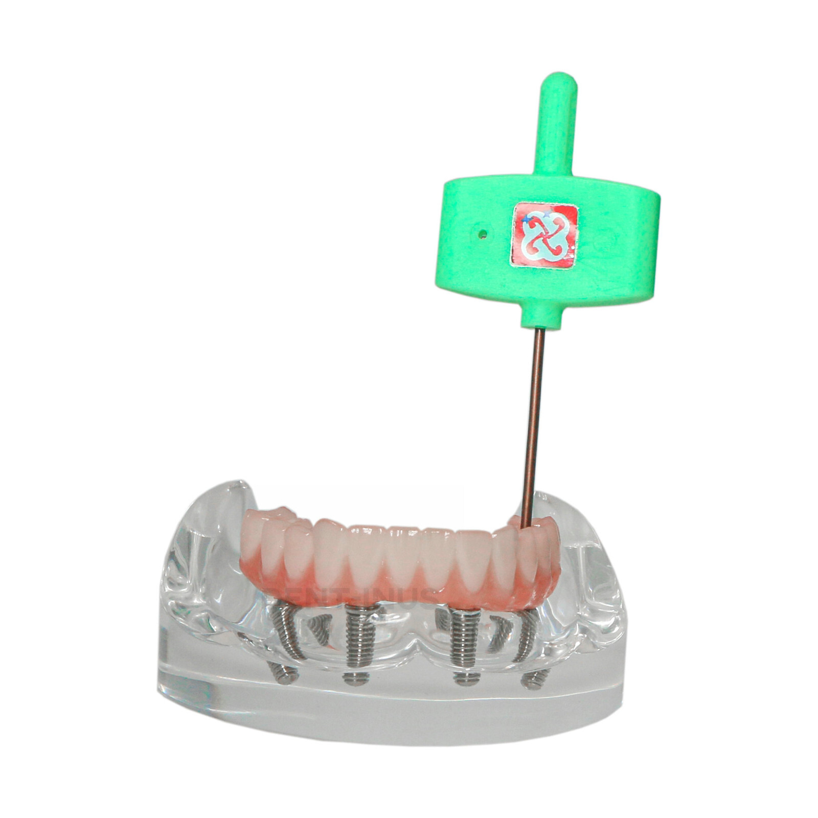 Dental 4 Implants Demo Implant Teeth Model Restoration Overdenture Upper/Lower