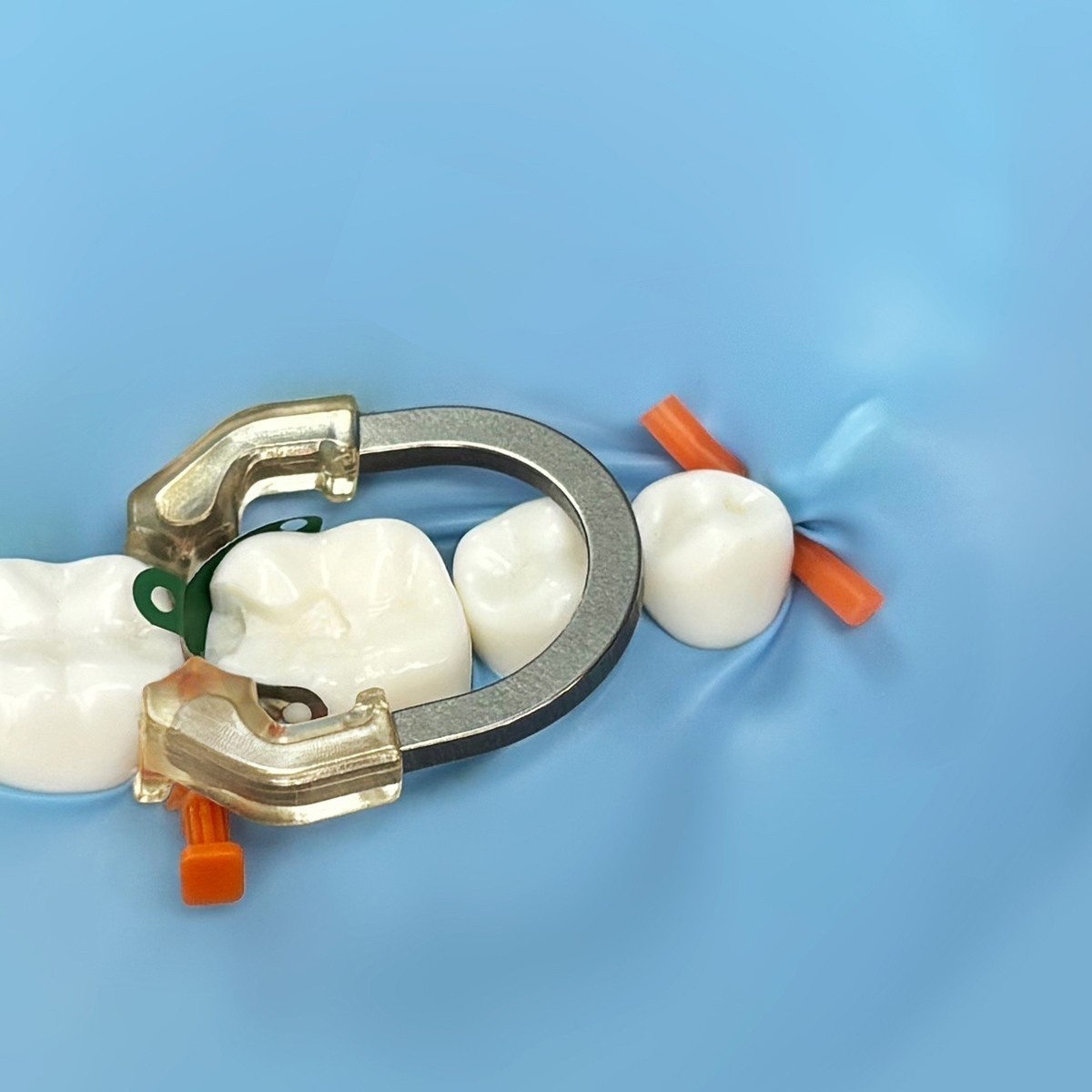 Dental NITI Transparent Matrix Clamp Ring R7 1.0 Seperator Rings Elastic Clear
