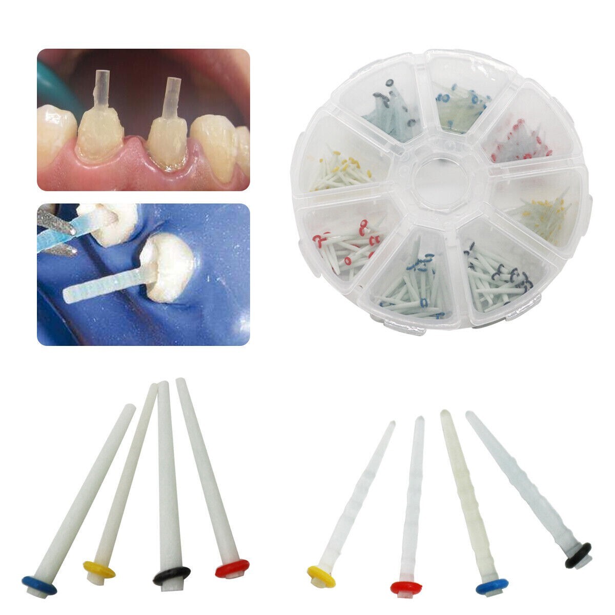 Dental Fiber Post Glass Quartz Teeth Restorative 1.2 1.4 1.6 1.8mm Posts 200 pcs