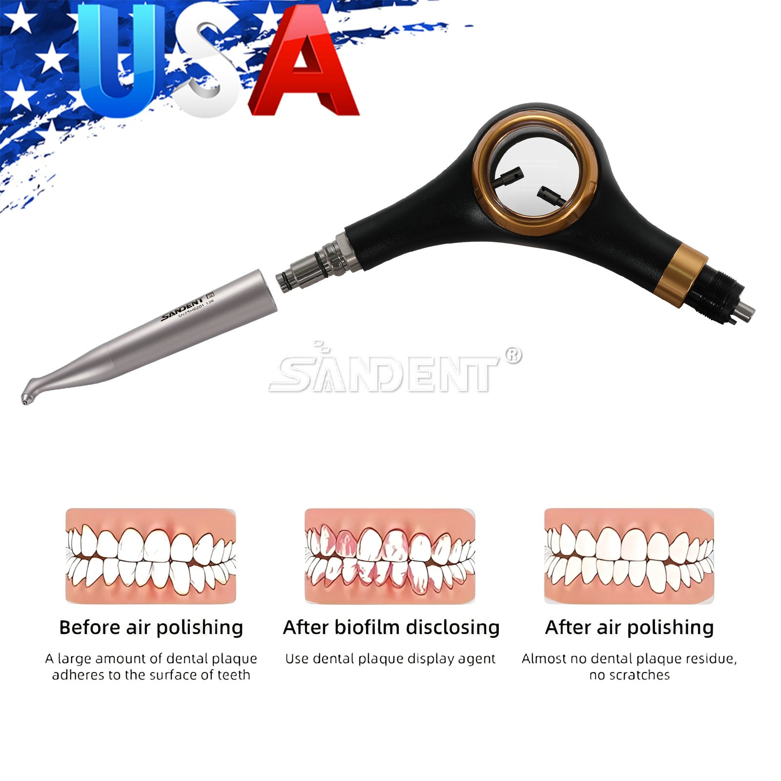 SANDENT Dental Air Polisher Supragingival Handpiece dt