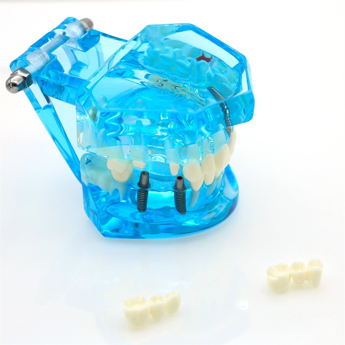 US Dental Typodont Teeth Model Implant Restoration Orthodontics Demo Teaching