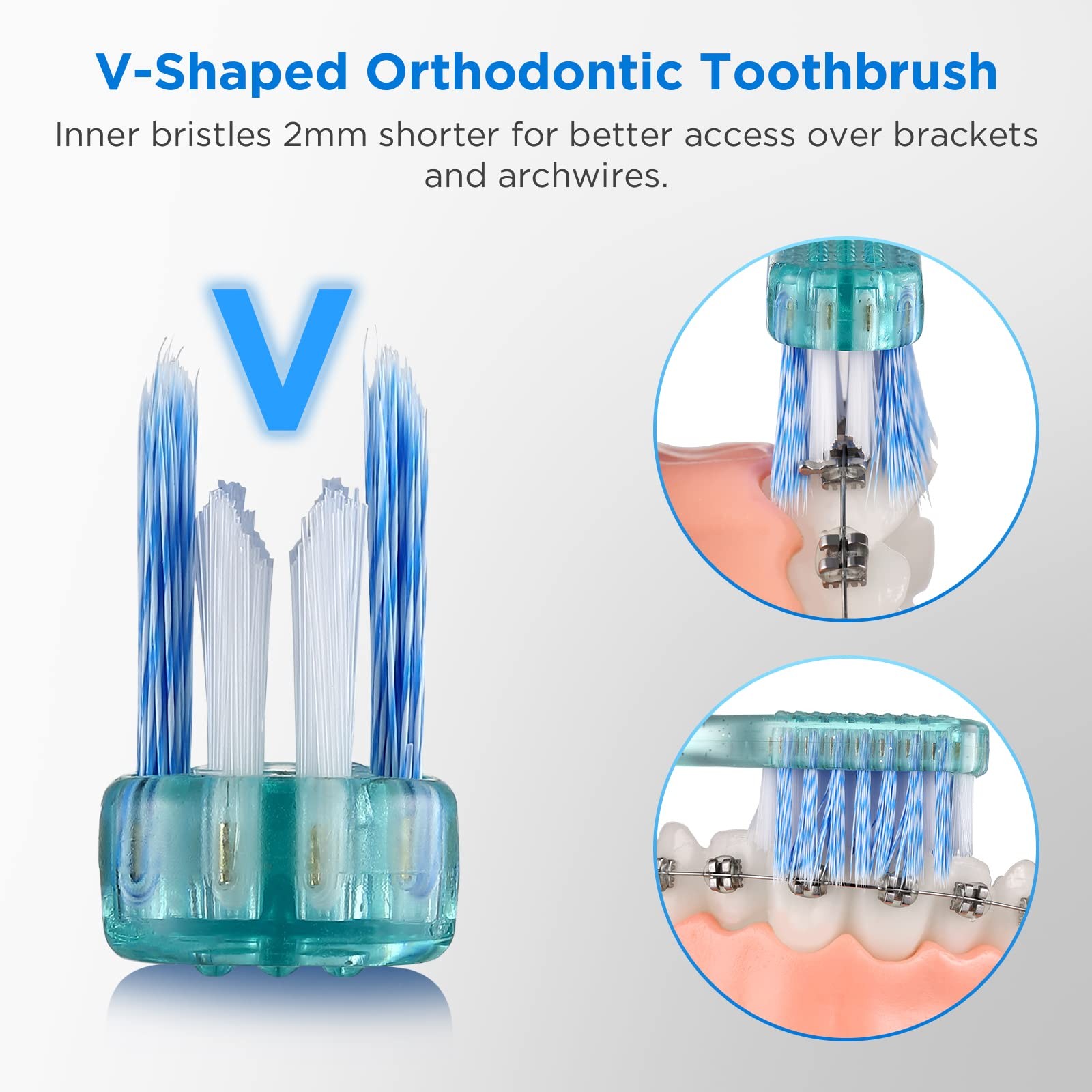 Fregum V-Shaped Orthodontic Toothbrush for 1 Count (Pack of 6), Multi-colored