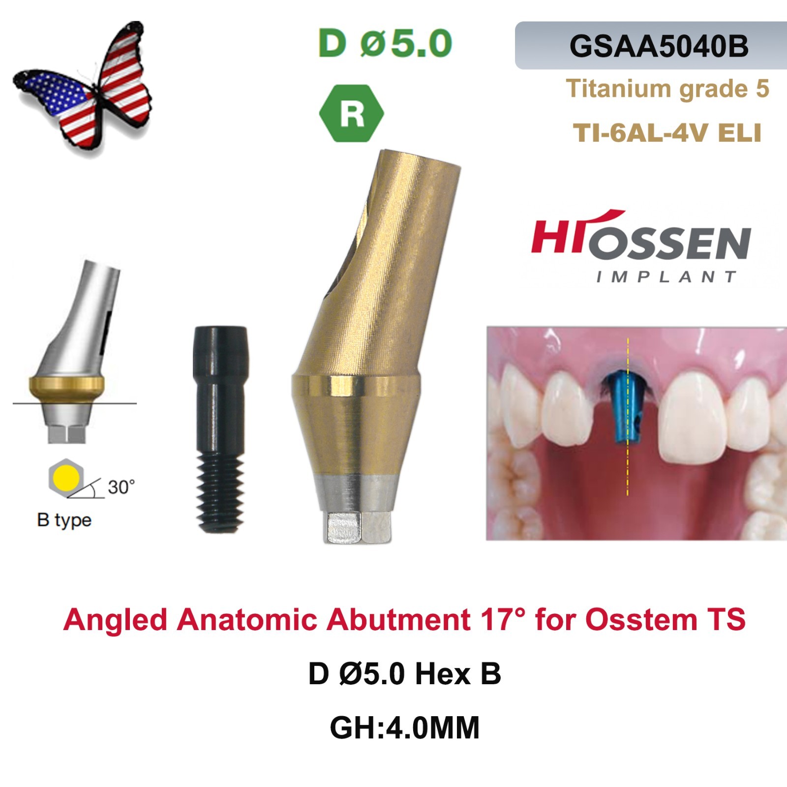 US 17° Dental Angled Anatomic Abutment Hiossen/Osstem TS Mini/Regular Platform