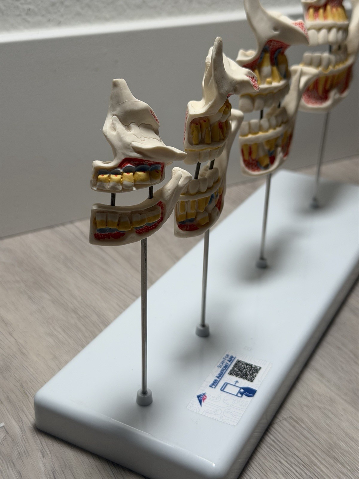 3B Scientific Dentition Development Model – 4 Stages Dental Teeth education