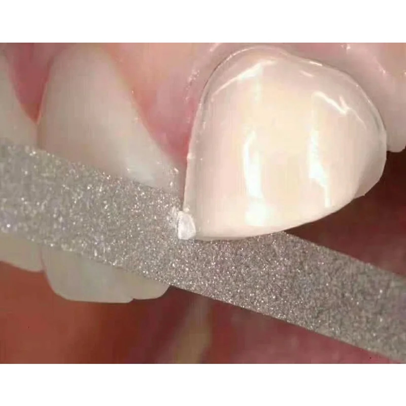 150*4mm Dental Microdont Stainless Steel Abrasive Strips for Finishing Polishing