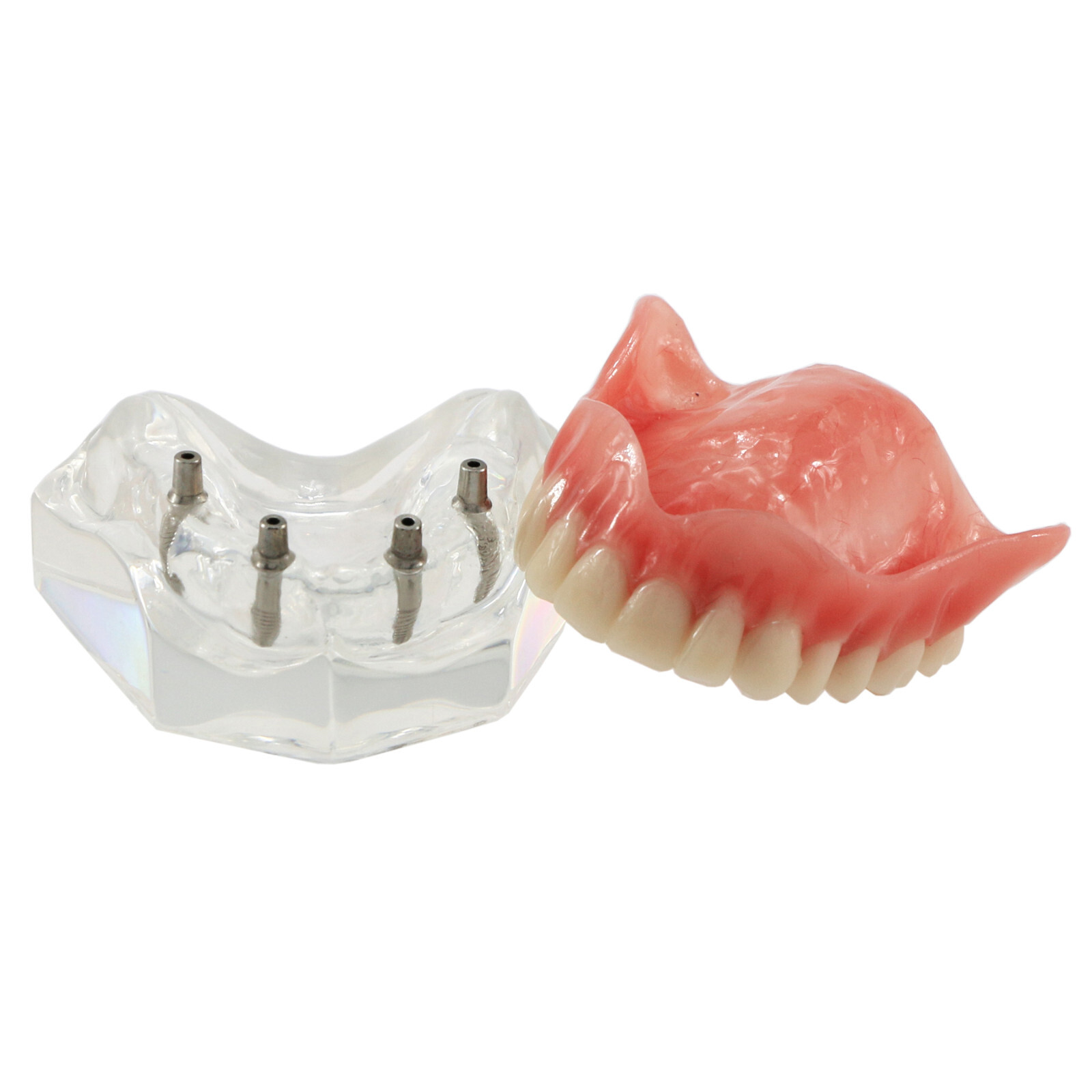 Implant Typodont Teeth Restoration Model Overdenture Practice Demo Series Dental