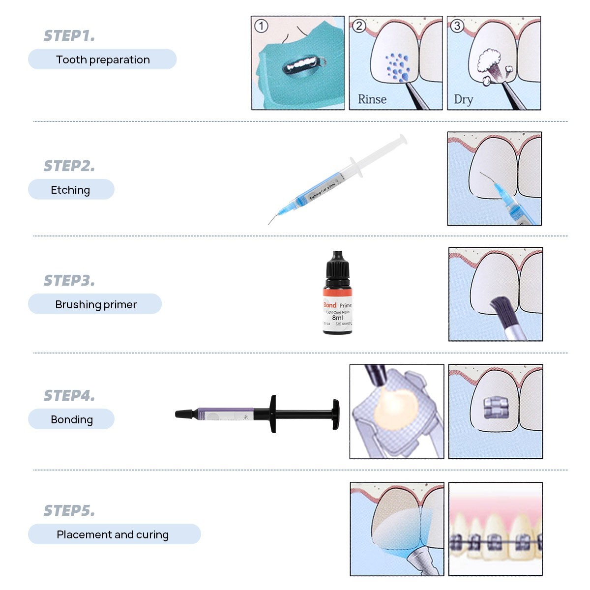 Dental Bracket Braces Glue Ortho Bonding Agents Light Cure Resin Adhesive Kit
