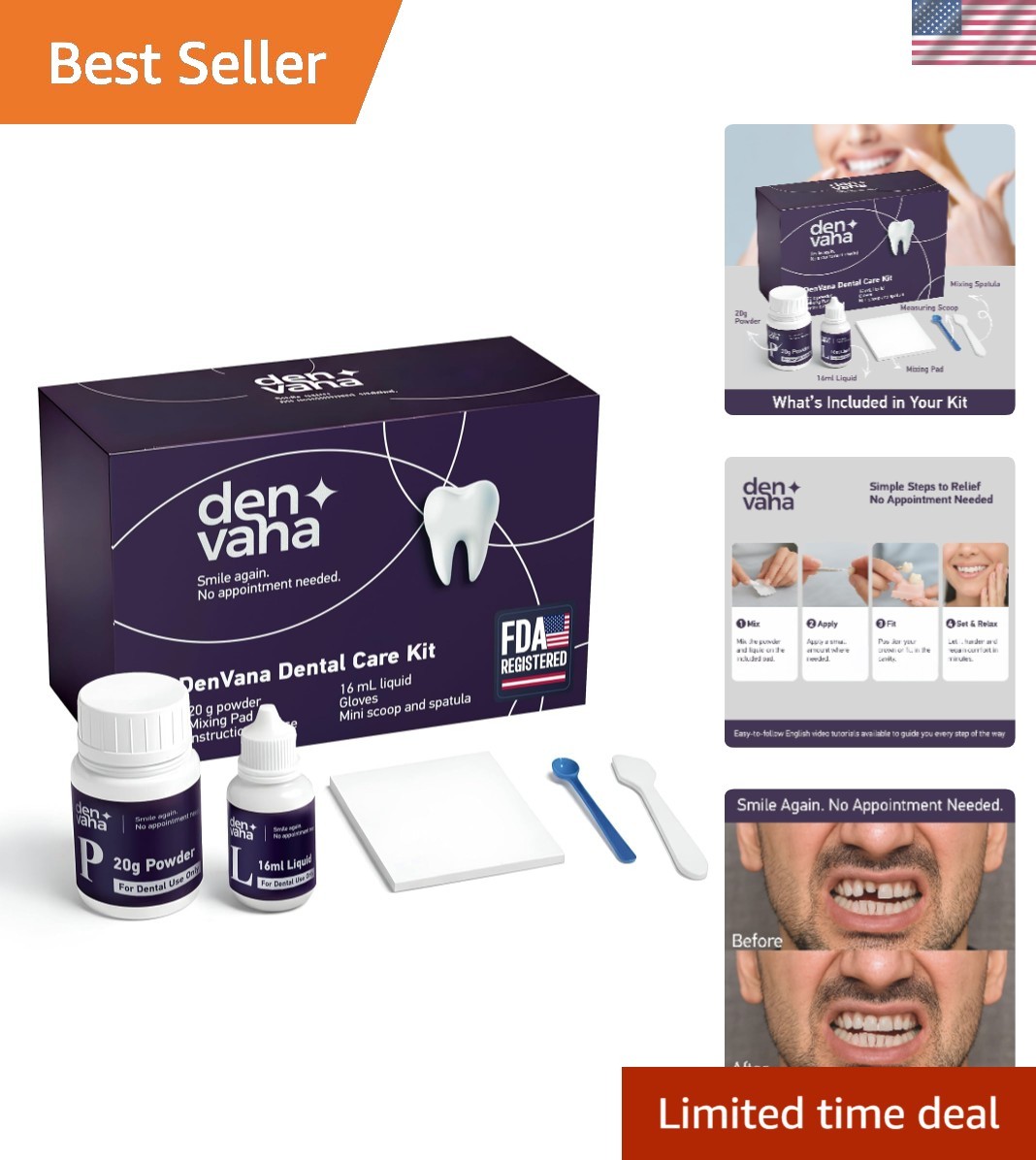 Professional Dental Cement Kit – Secure Solutions for Broken Crowns & Loose Caps