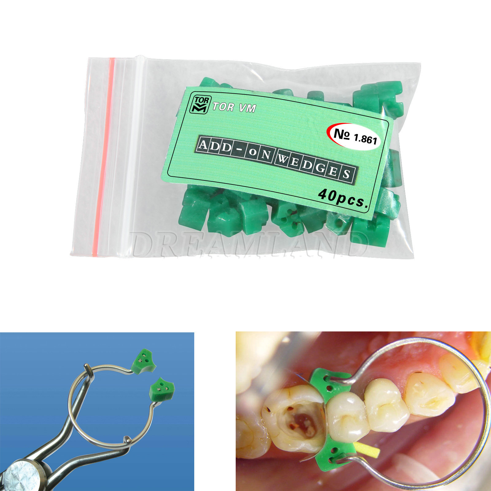 New Dental Add On Wedges Orthodontic Special Silicone Rubber 40pcs/pack