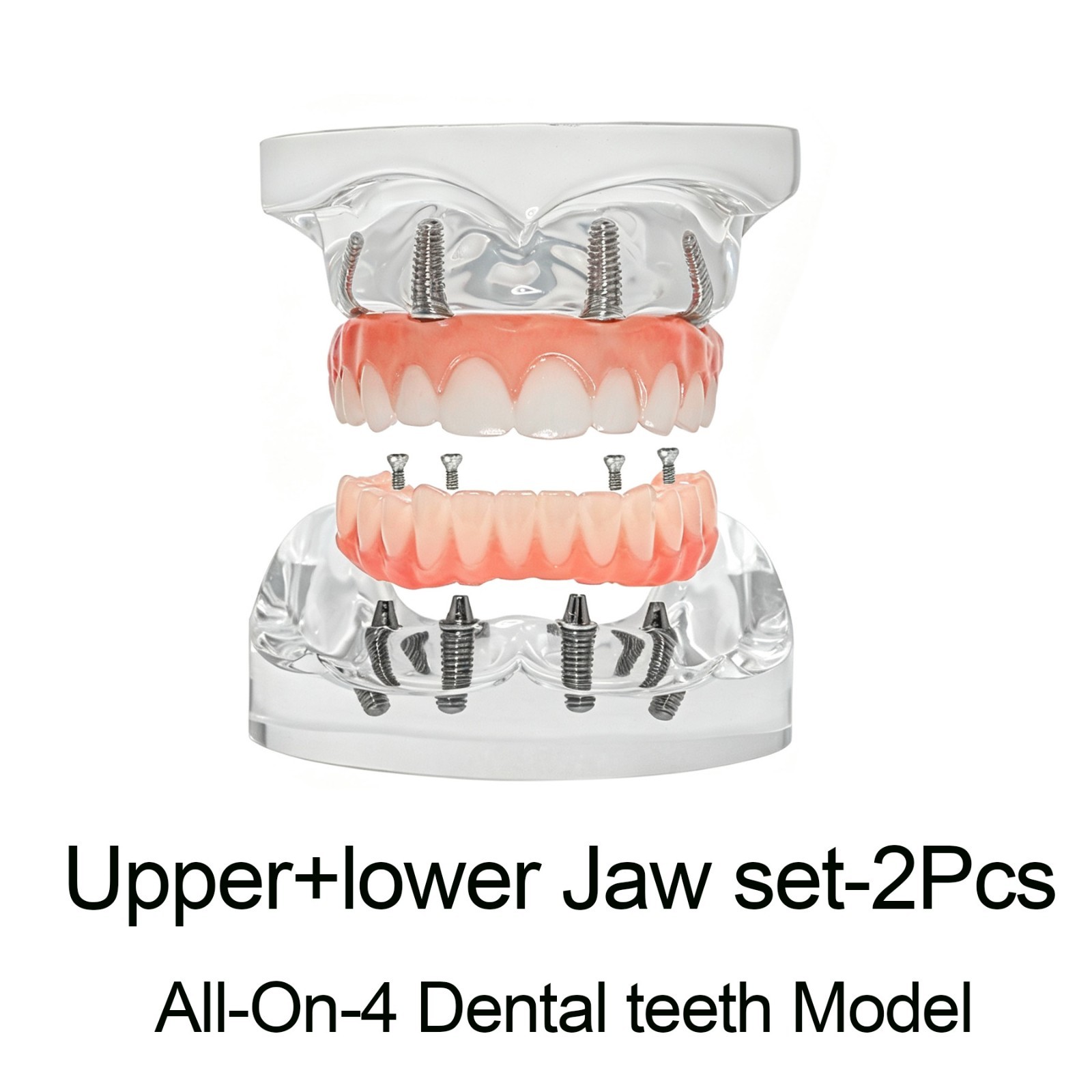 Clear Base Detachable All-on-4 /All-on-6 Overdenture Dental Implant Study Model