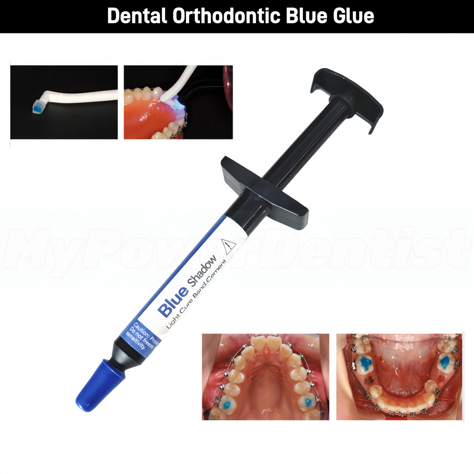 Dental TURBO Blue Glue Composite Resin 5ml Orthodontic Adhesive Light Cure Band