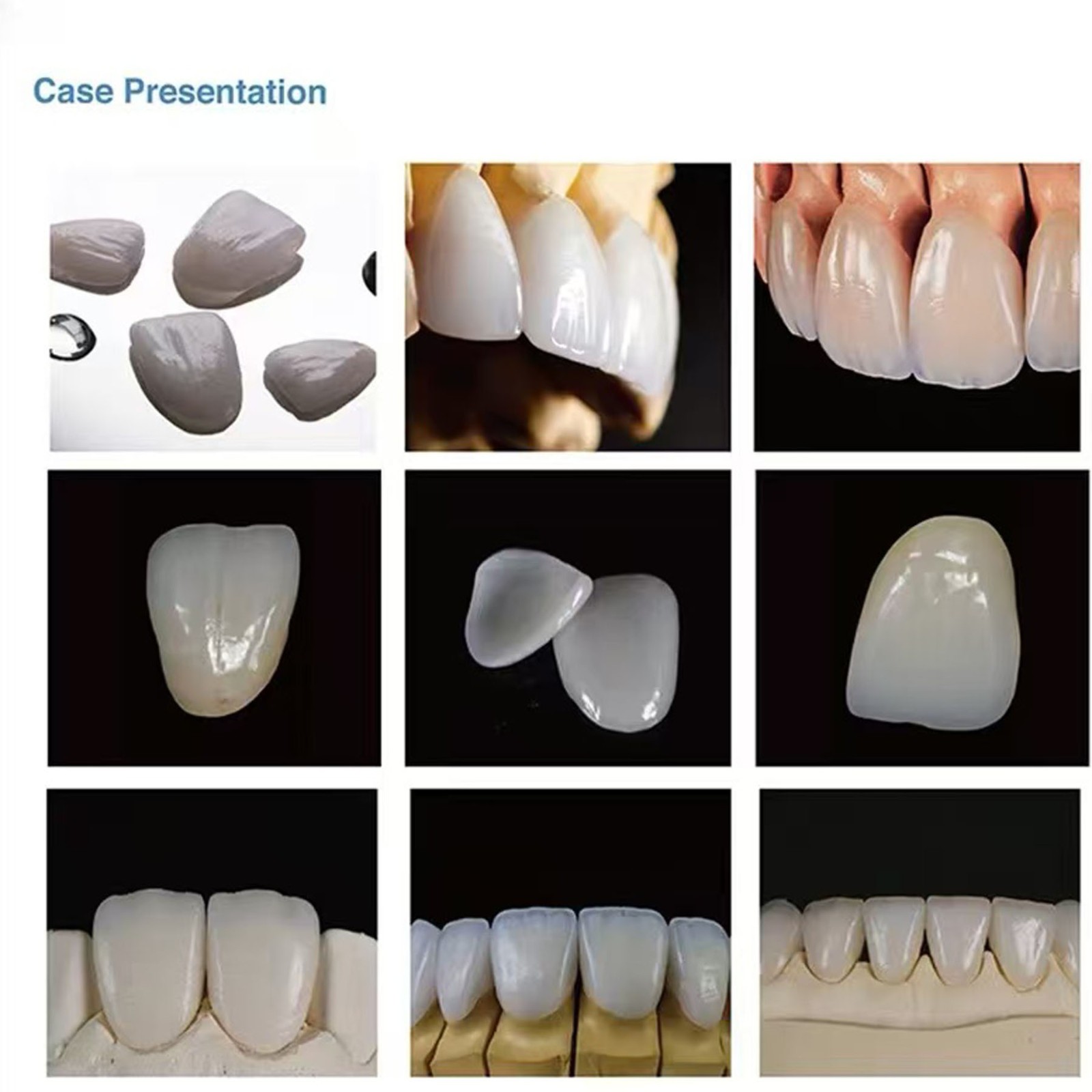 Dental Emax CAD/CAM Glass Ceramic Lithium Disilicate Blocks All Types for CEREC