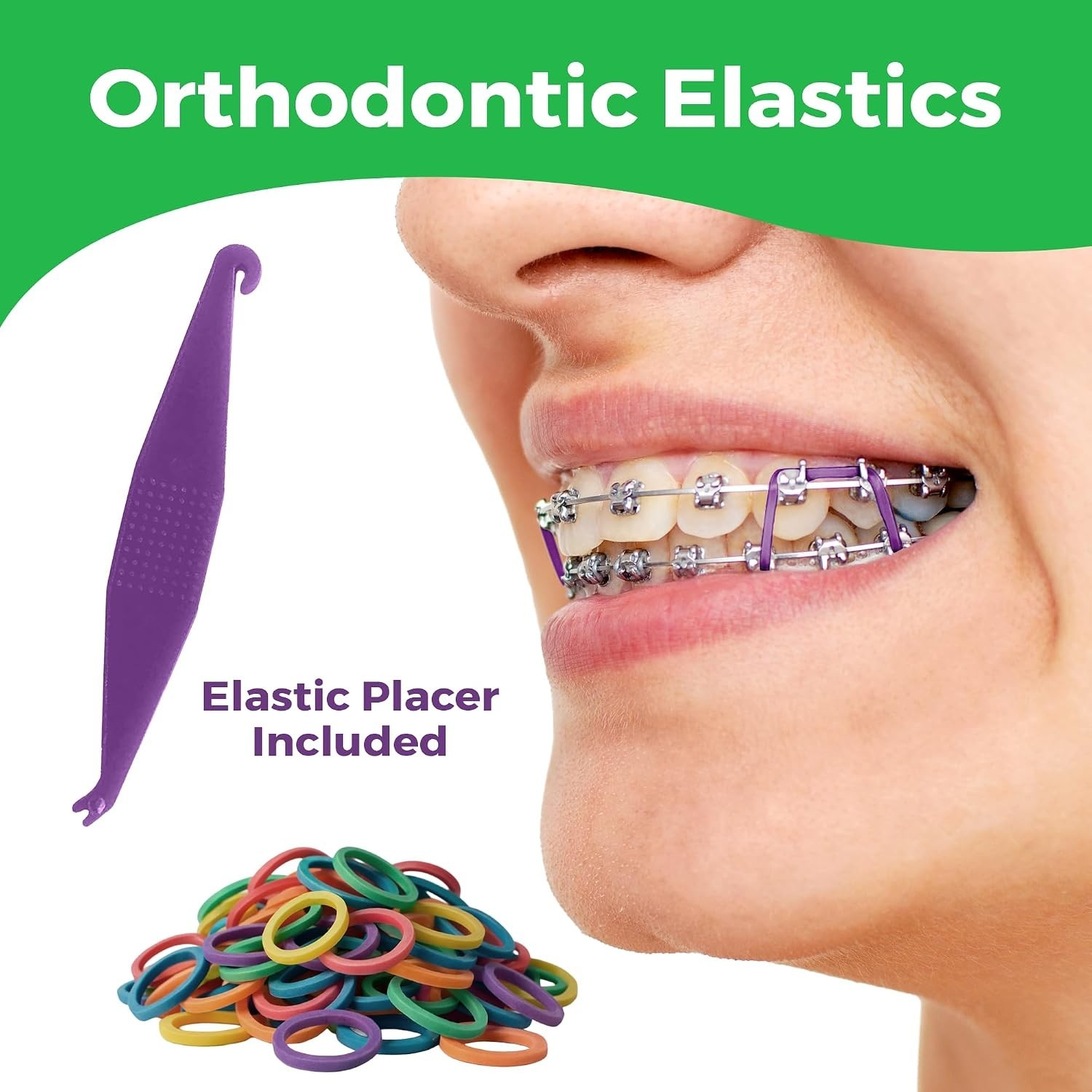 Durable Neon Rubber Bands for Braces 300 Pack – Perfect for Orthodontics & Hair