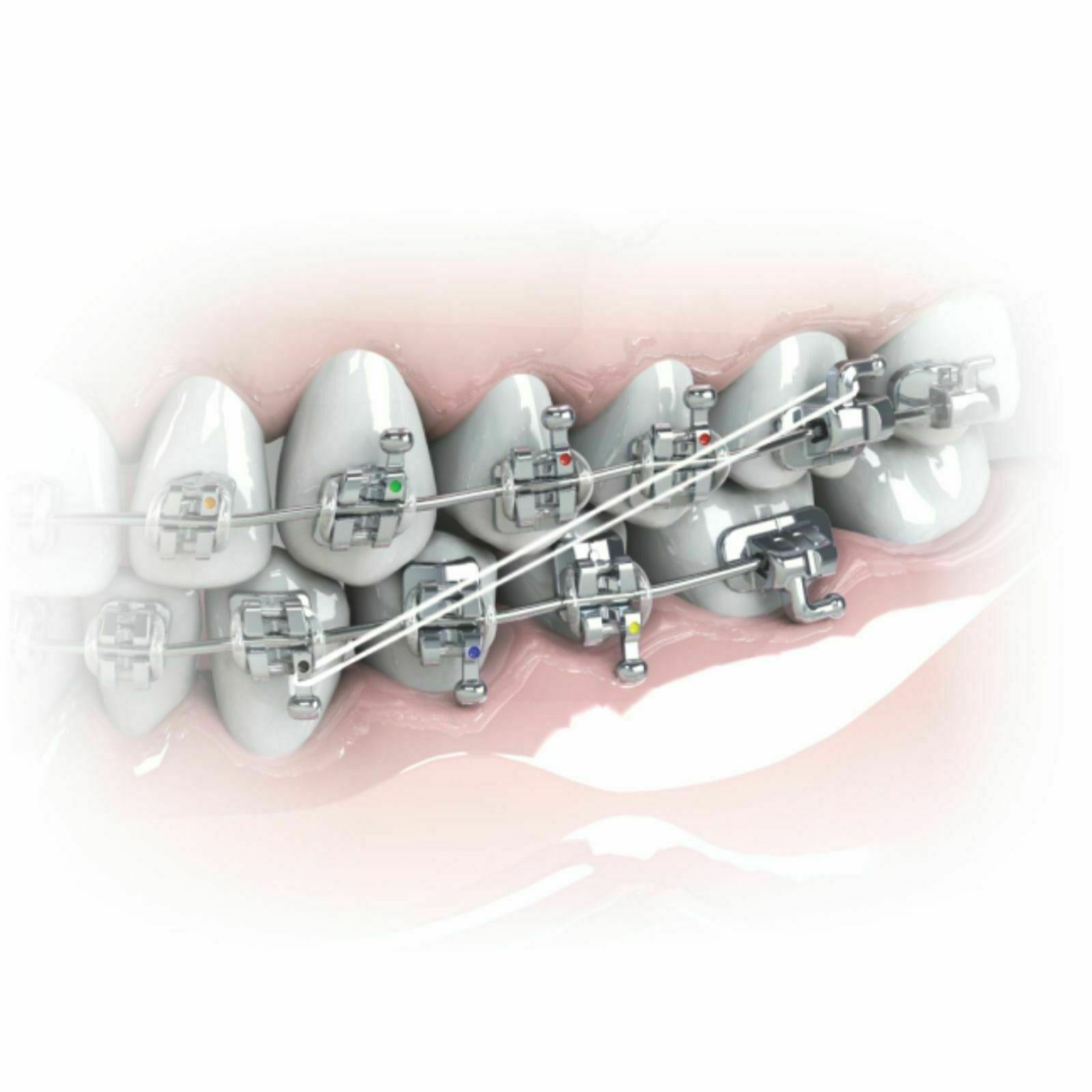 100 pcs Dental Orthodontic Intraoral Elastic Latex-Free Rubber Band Clear USA