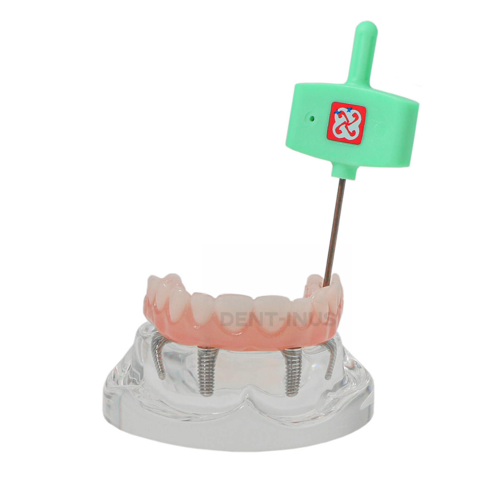 Dental 4 Implants Demo Implant Teeth Model Restoration Overdenture Upper/Lower