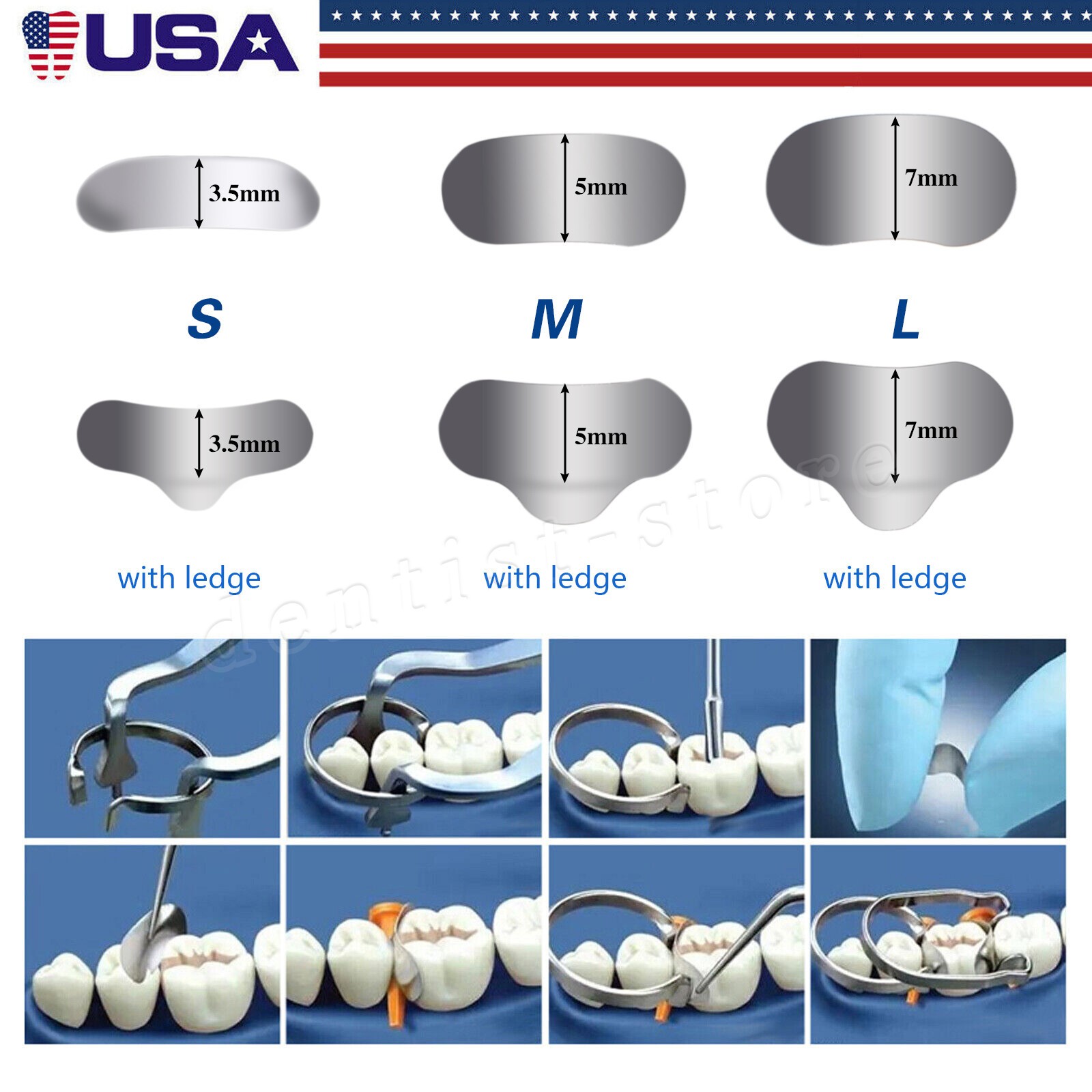 SANDENT Dental Metal Matrices Sectional Contoured Matrix Resin Refill Bands dt