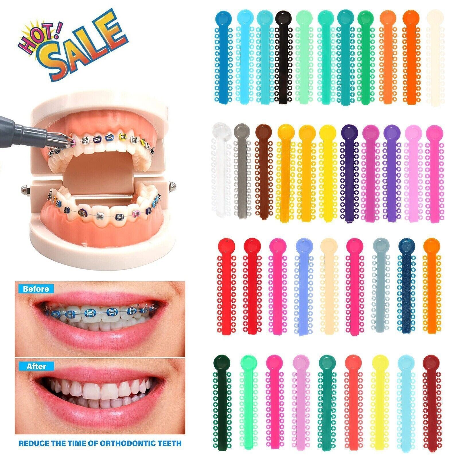 1040Pcs Dental Orthodontic Elastic Ligature Ties Rubber Bands for Brackets Brace