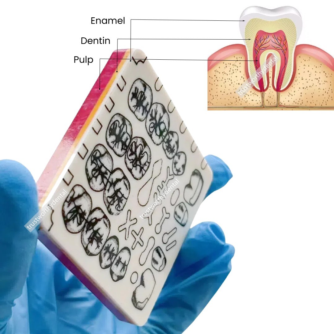 Dental Cavity Preparation Hole Dentin Practise Model Filling Template US STOCK