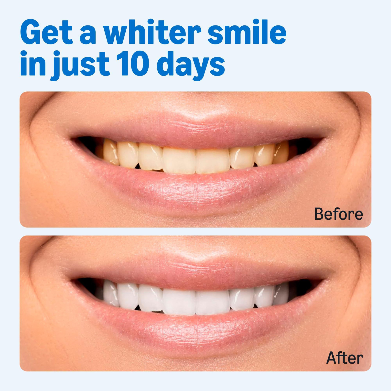 Amazon Basics 10 Day Teeth Whitening Strips Kit, 20 Count (Pack of 1), White