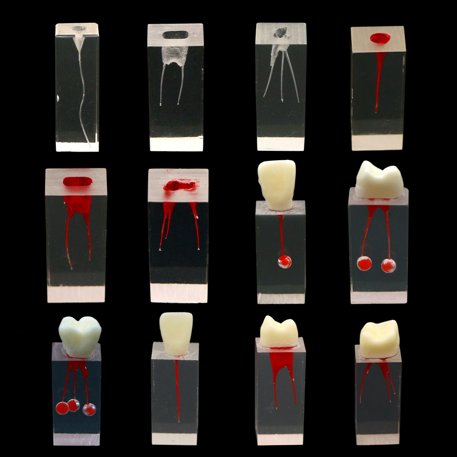 10Pcs Dental Endo Root Canals Teeth Model Practice Block RCT Pulp Cavity Study