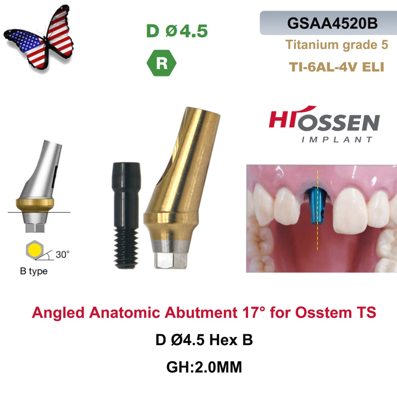 US 17° Dental Angled Anatomic Abutment Hiossen/Osstem TS Mini/Regular Platform