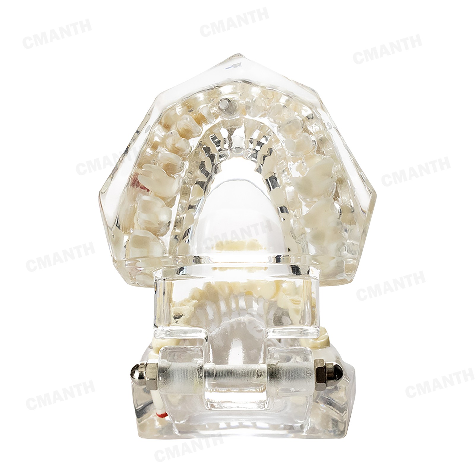 US Dental Teeth Implant Restoration Model Transparent Pathological Study Demo