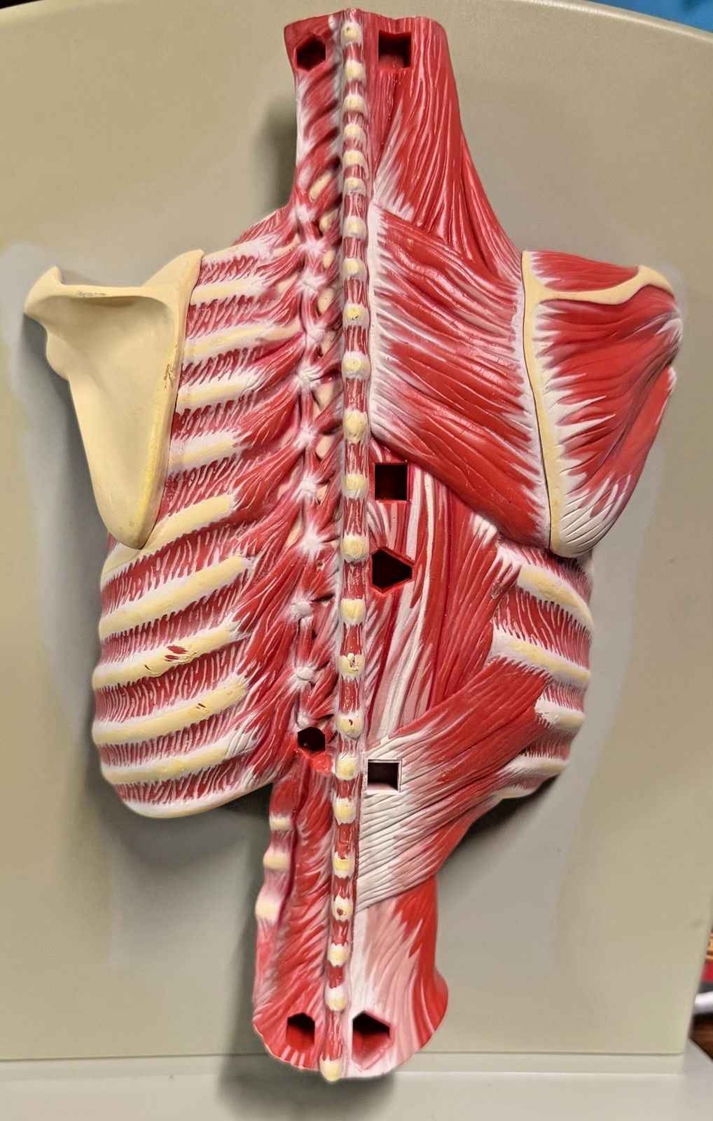 VINTAGE 2006 MEDICAL ANATOMICAL HUMAN SPINE BACK MODEL PHYSICIAN OFFICE DISPLAY