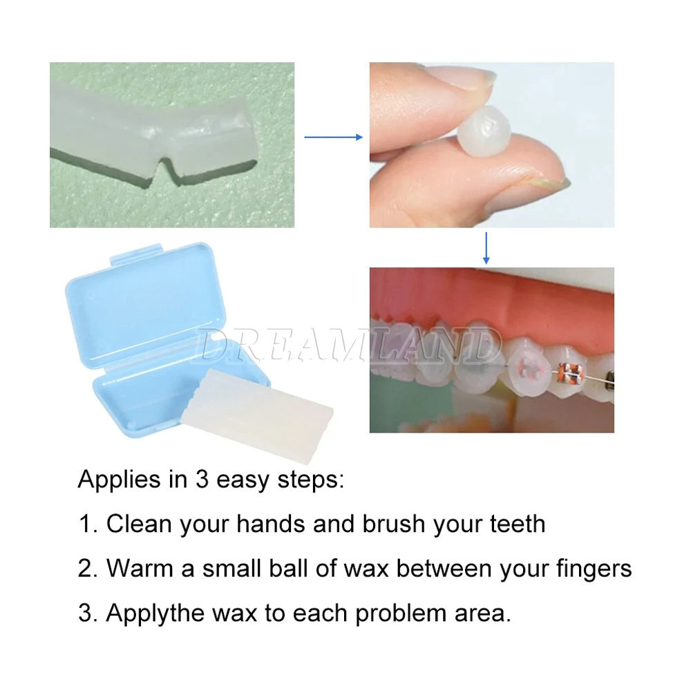 10 /20/ 50 Pack Orthodontic Wax – Relief for Braces Irritation Scent & Unscented