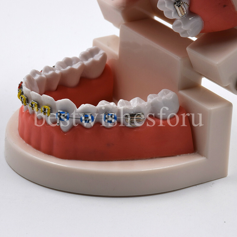 1*Dental Orthodontic Standard Teeth Tooth Model Metal Brackets & Ligature Ties