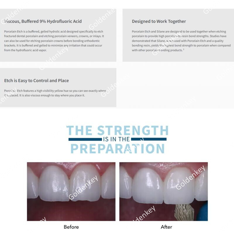 Dental Porcelain Etch Silane Ultradent 9% Hydrofluoric Repari Kit