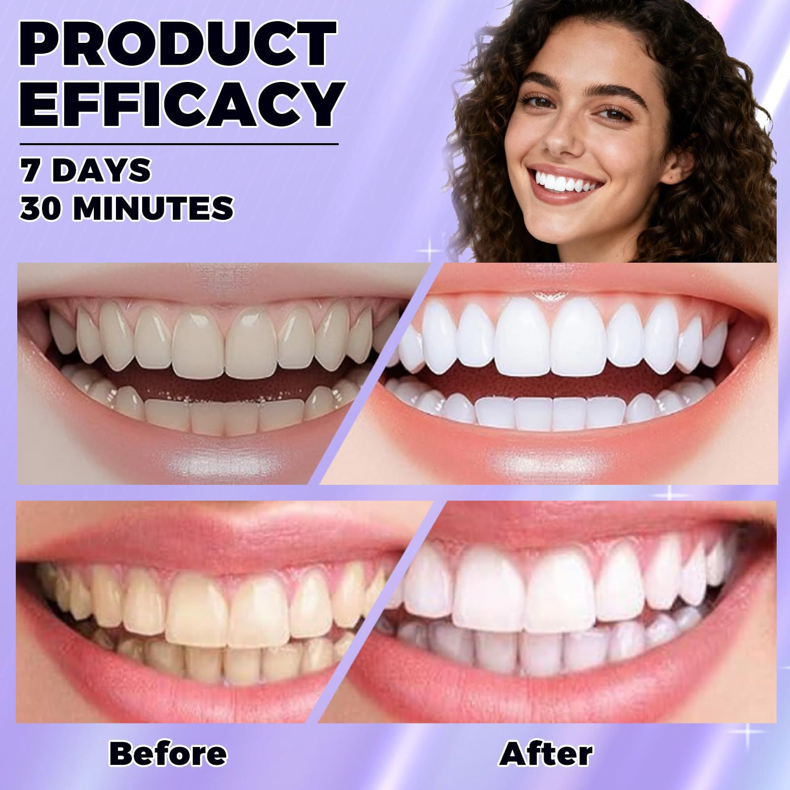 14 PCS Purple Teeth Whitening Strips, Smile 1 Count (Pack of 1)