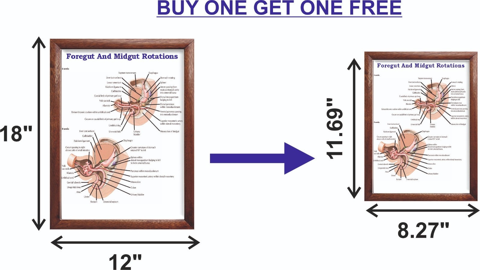Foregut And Midgut Rotations Chart 12×18 inches