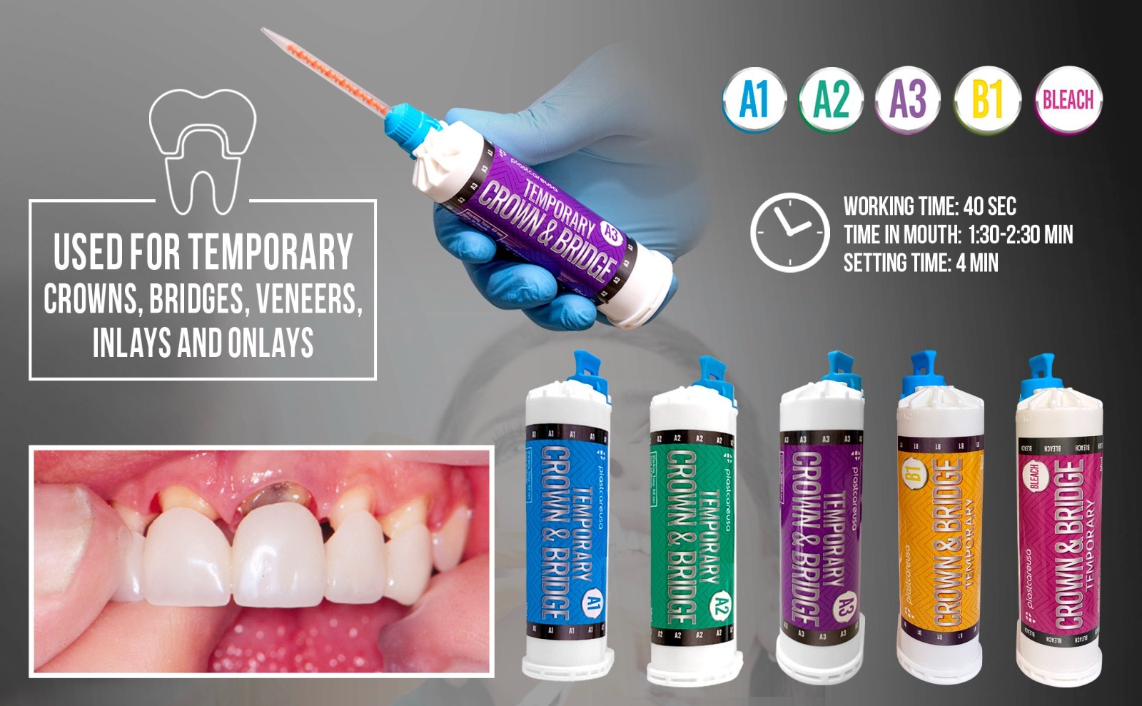 Bleach Temporary Crown & Bridge Material 10:1 Dental Impression 76g, Made in GER