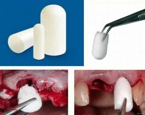 Pack of 10 Cologenesis Colo Plug Sterile Collagen Sponge 8x20mm (Fast Shipping)