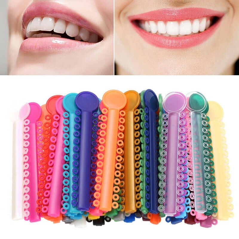 Multi-Color 1040 Ties Dental Orthodontic Ligature Ties Elastic Rubber Band Brace