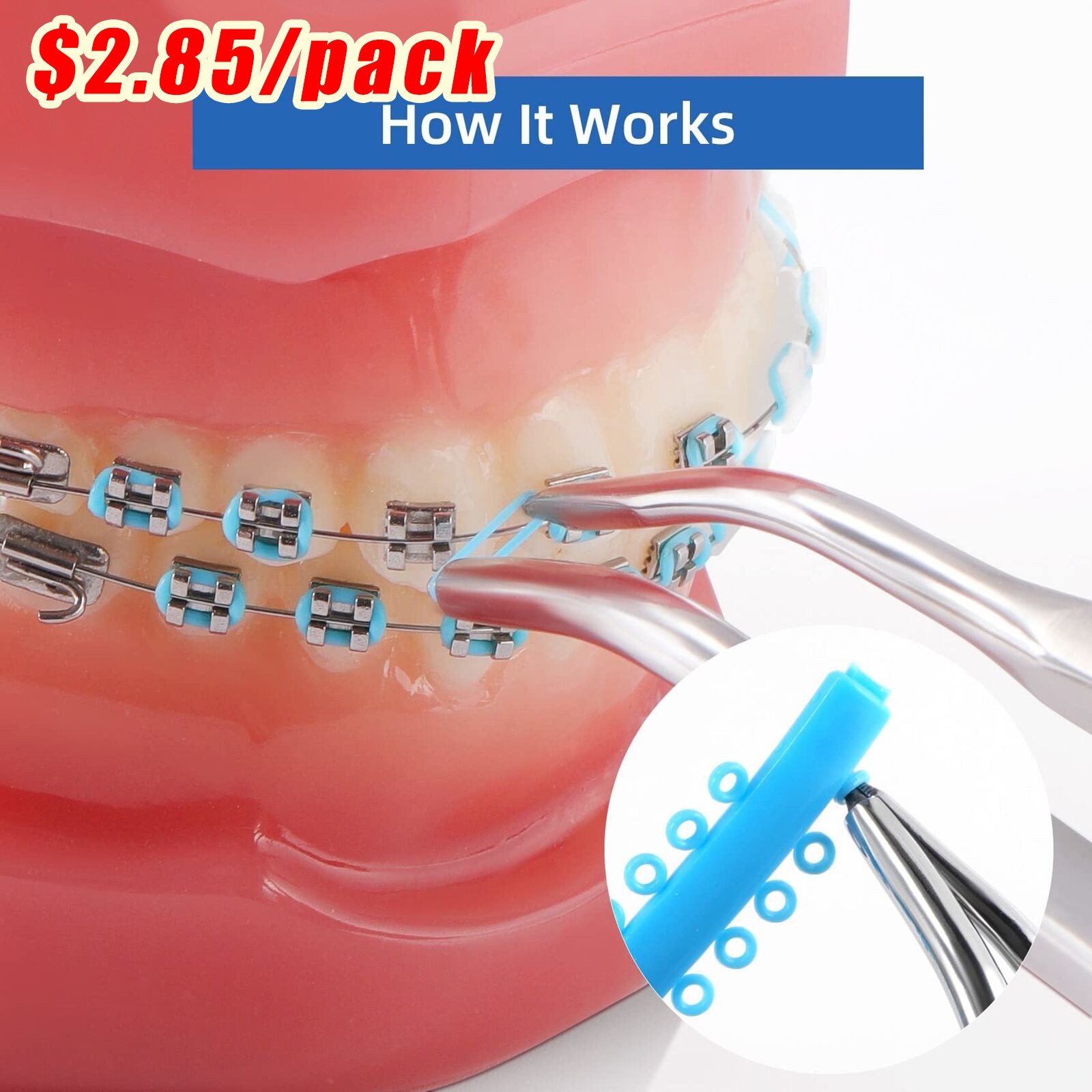 1040Pcs/Pack Dental Orthodontic Ligature Ties Elastic Rubber Bands Braces SKYSEA