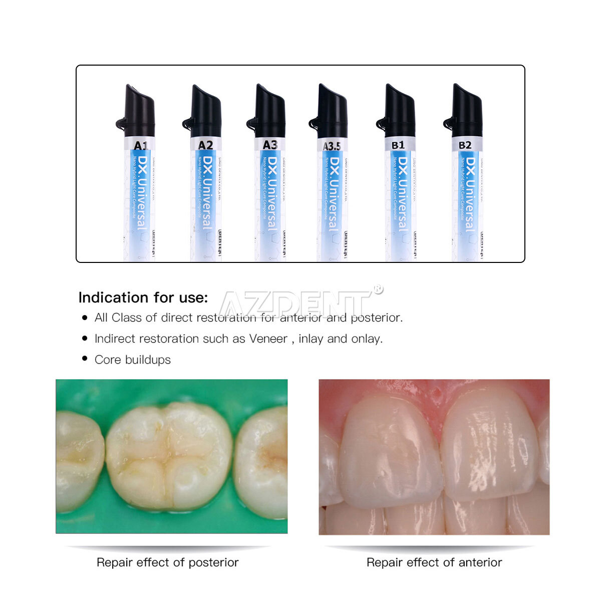 DENTEX Dental Universal Light Cure Composite Resin/Etching Gel/Bonding Adhesive