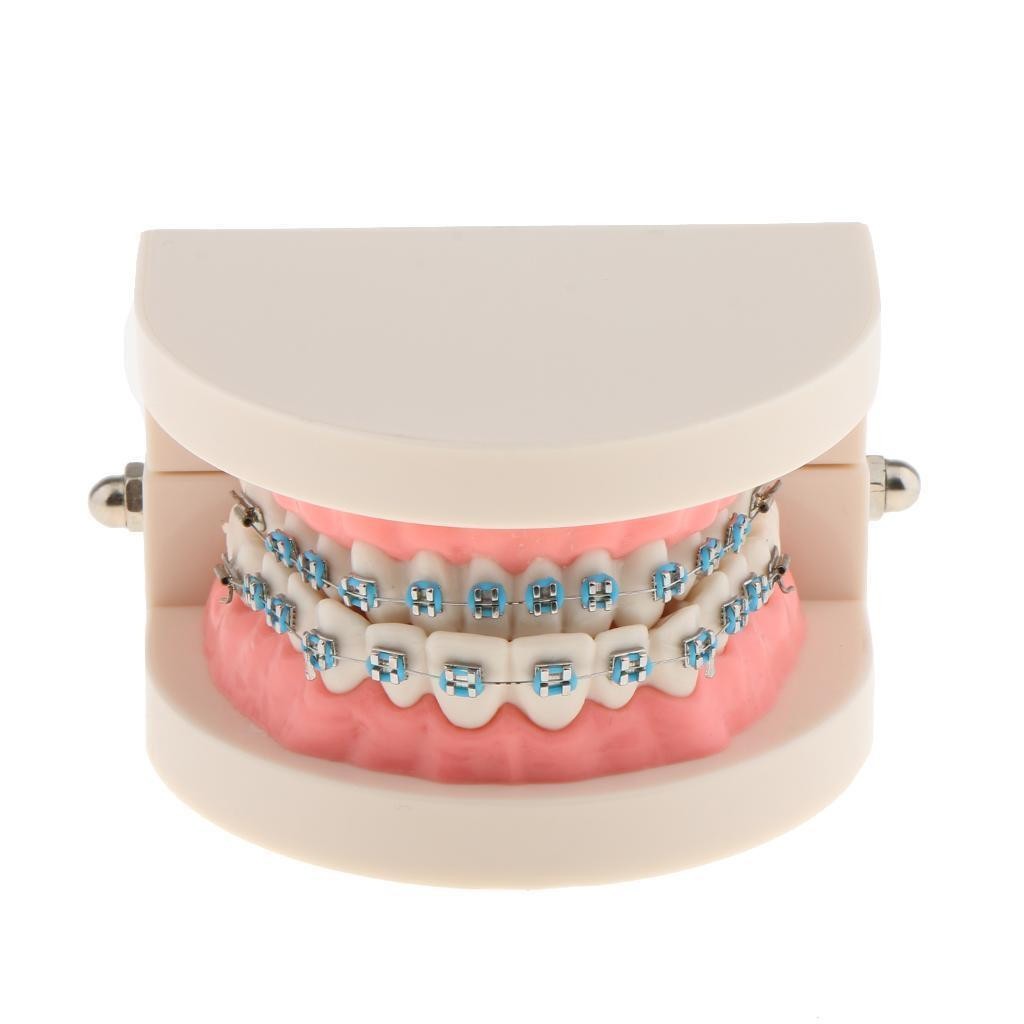 Dental Metal Model Orthodontic Adult Standard Teeth Hoop Brackets Ligature Tie