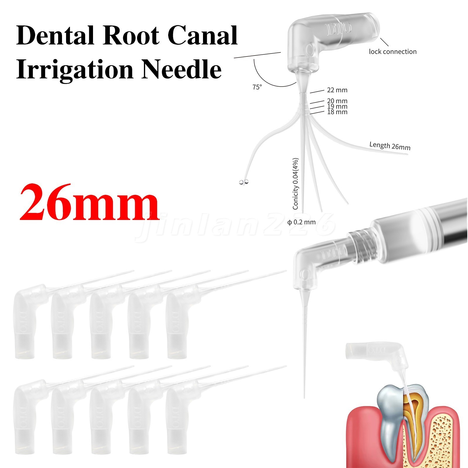 20-400Pcs Dental Endo Root Canal Tip Irrigator Irrigation Needle Tips Flushing
