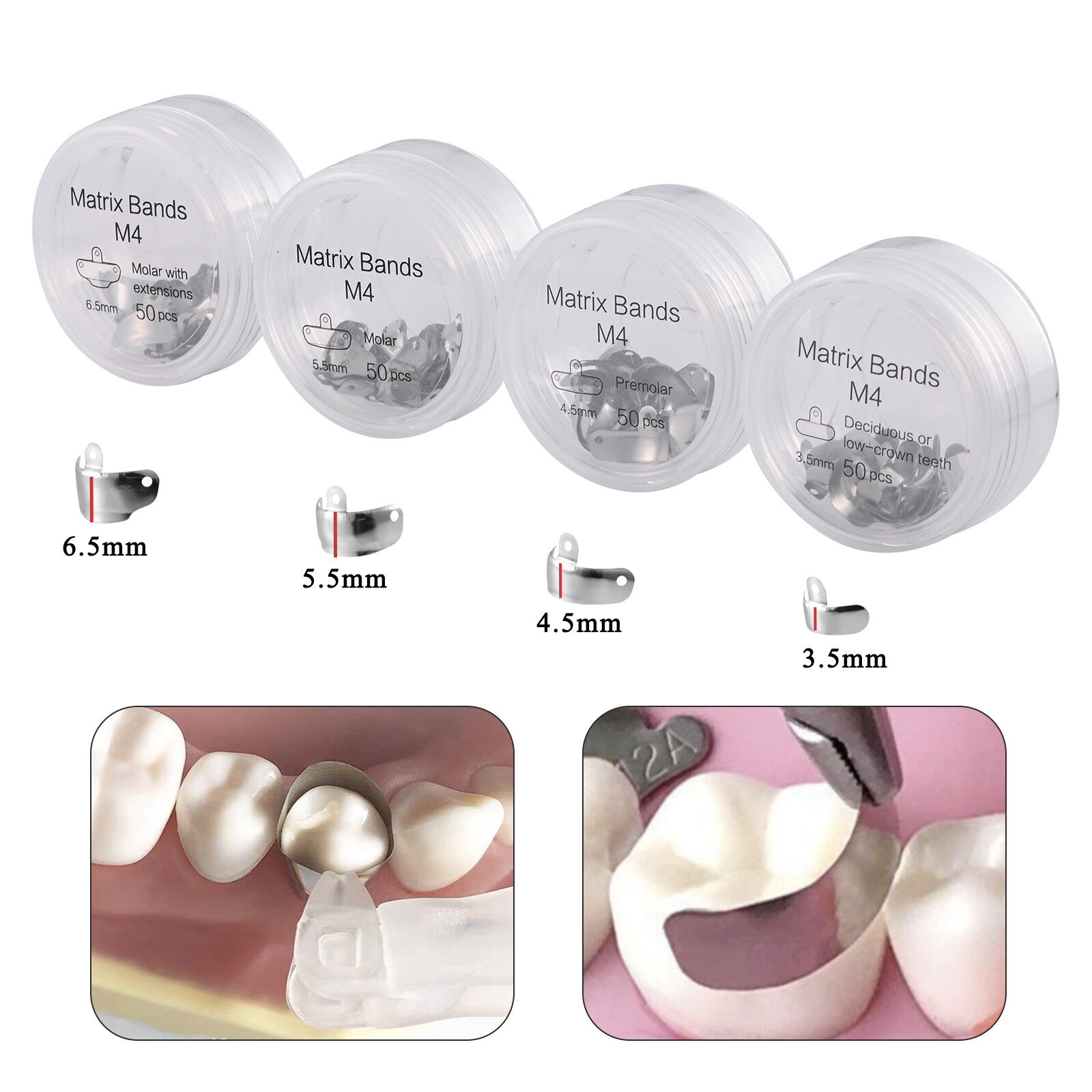 50pcs/Box Dental Metal Matrices Sectional Contoured Matrix Refill Soft Band