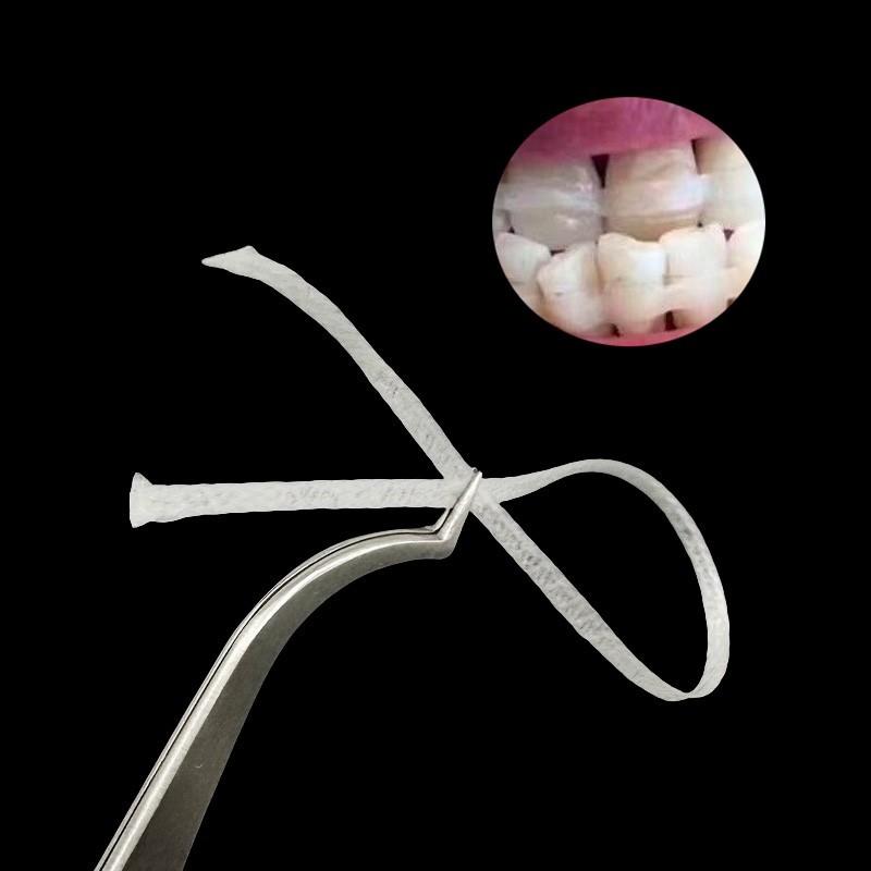 Dental Flexible Fiber Strip Glass Splint Loose Tooth Fixat Strip Light Cure Bond