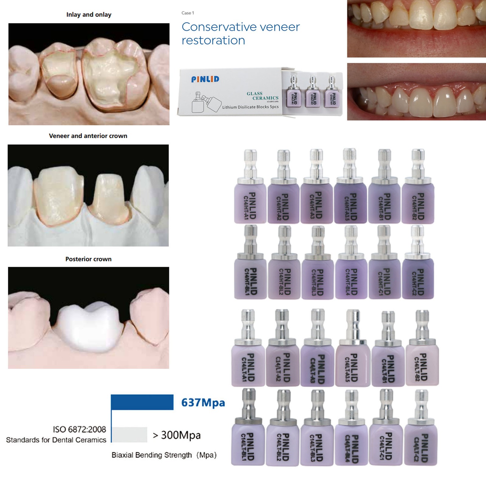 US C14 Dental Lithium Dislicate Block For Sirona Cerec IPS e.max CAD CEREC Block