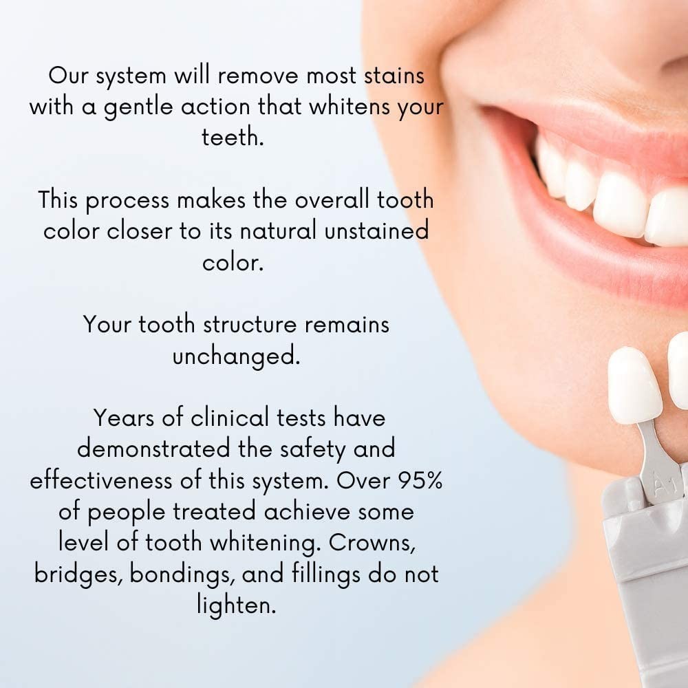 White Teeth GLobal Whitening Gel 44% Carbamide 1 Count (Pack of 1)