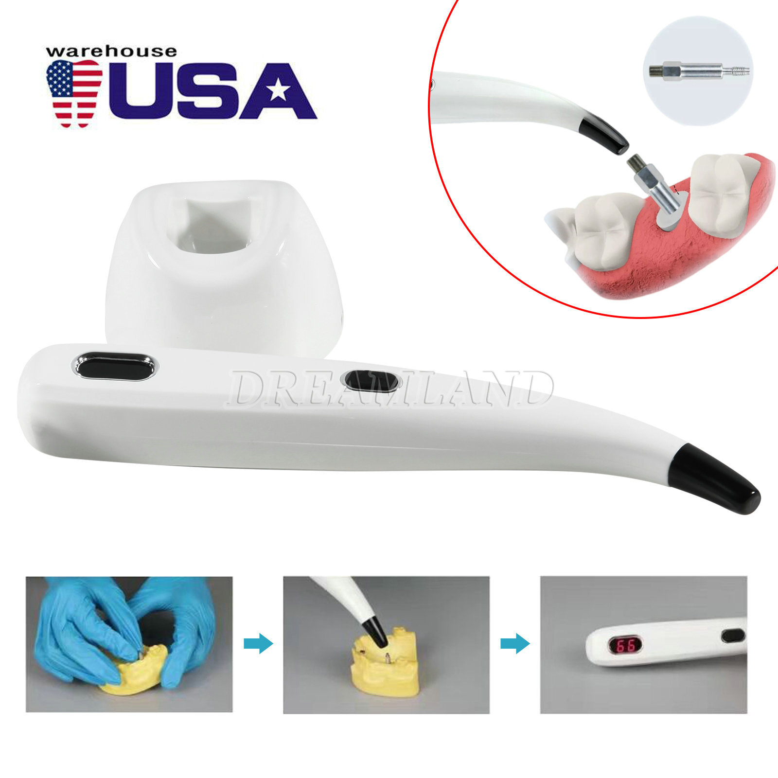 Dental Monitor Osseointegration RFA Inplant Stability Test Unit ISQ USA
