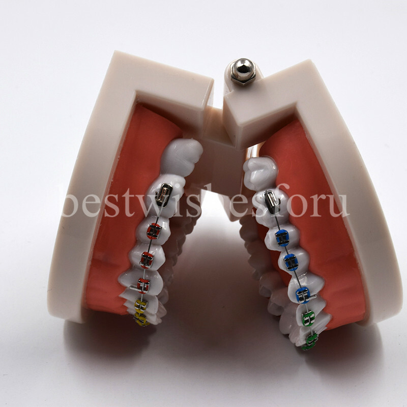 1*Dental Orthodontic Standard Teeth Tooth Model Metal Brackets & Ligature Ties