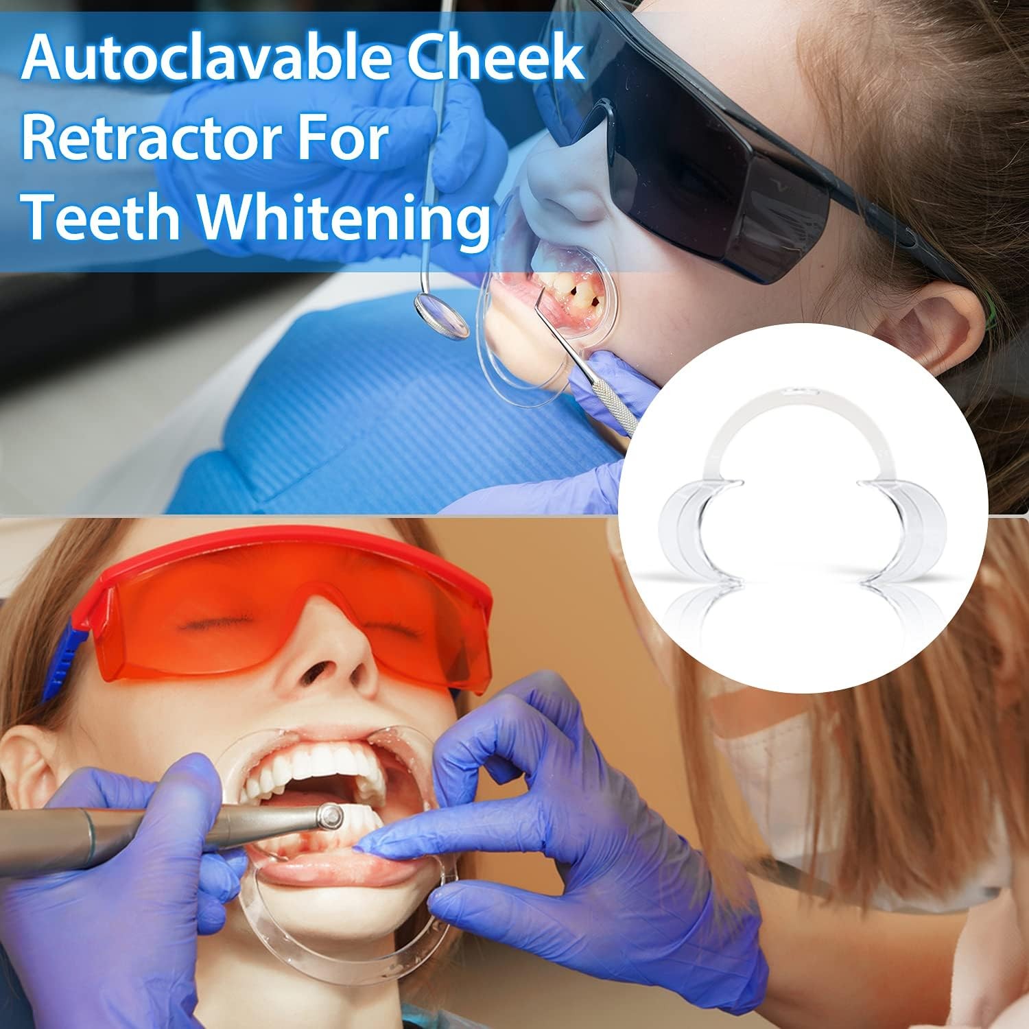 EZGO 20 Pieces (Size M) C-Shape Teeth Whitening Cheek 20 Count (Pack of 1)