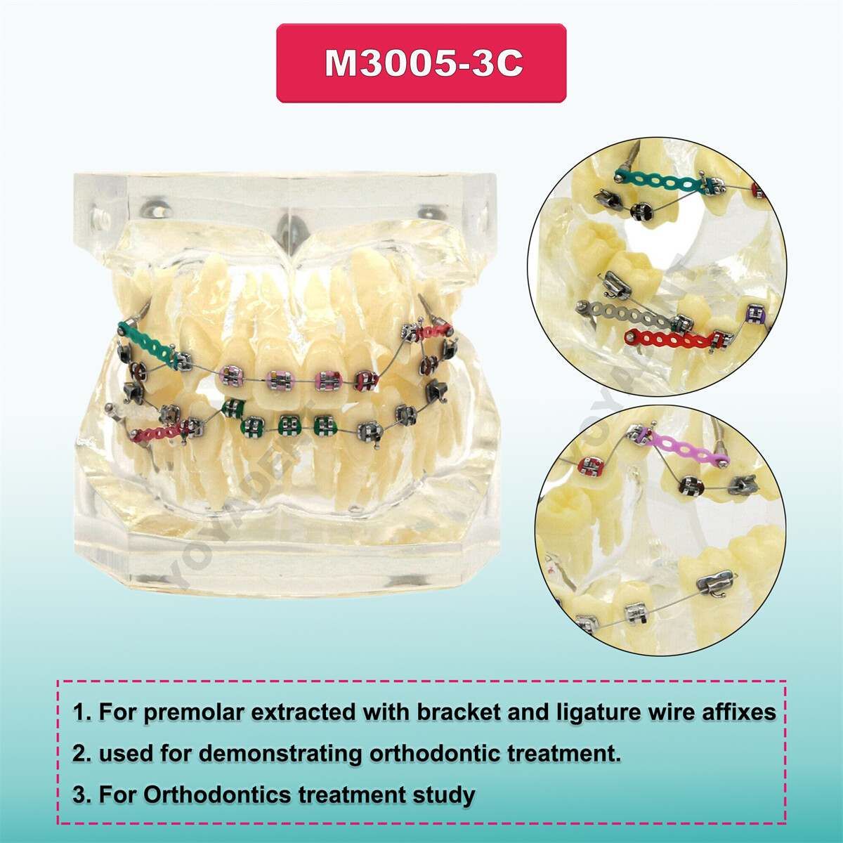 Dental Typodont Teeth Model Orthodontic Treatment Metal Ceramic BracketsRetainer