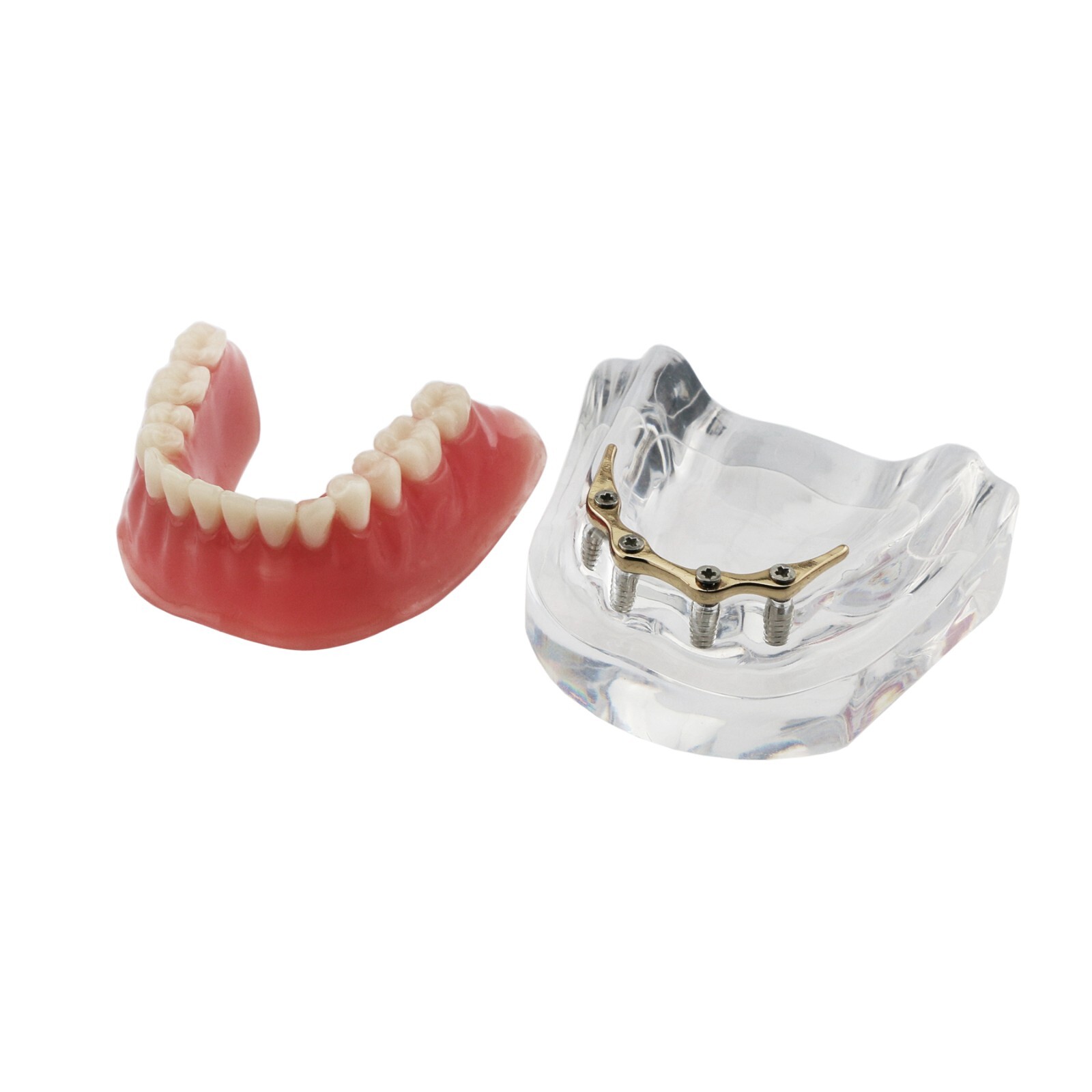 Dental Typodont Teeth Model Ortho Implant Pathological Perio Practice Demo Model